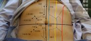 Sources Acupuncture Massage